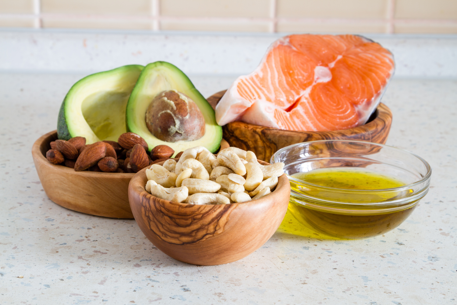 l carnitina​ l carnitine​ l carnitina para que serve